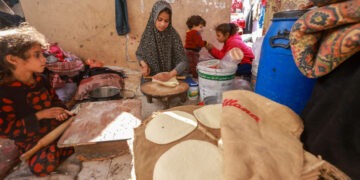 تسجيل حالات جدري بين أطفال غزة